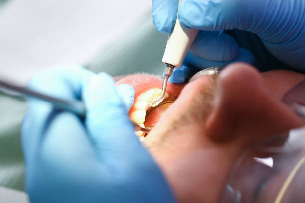 Best Emergency Dental Surgery in Mccrory, AR