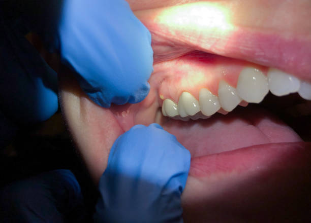 Best Urgent Dental Care in Mccrory, AR
