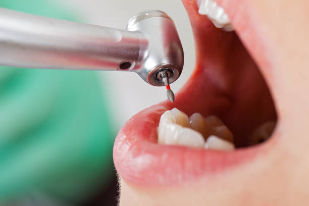 Best Same-Day Emergency Dentist in Mccrory, AR